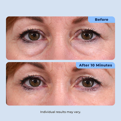 Rapid Reduction Serum – 1-Month Supply Plexaderm®