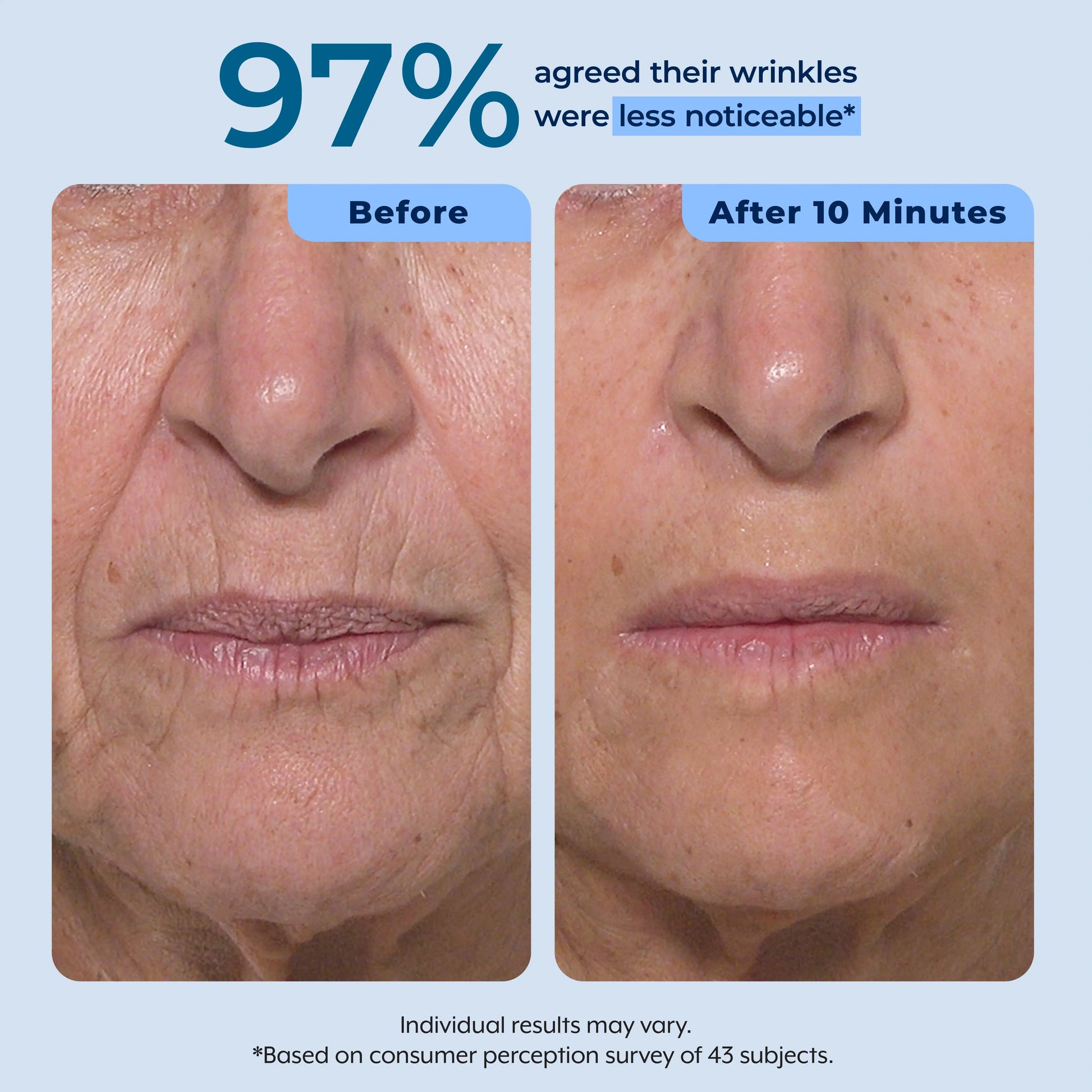 Rapid Reduction Serum – 1-Month Supply Plexaderm®