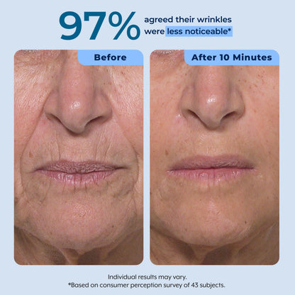Rapid Reduction Serum – 1-Month Supply Plexaderm®