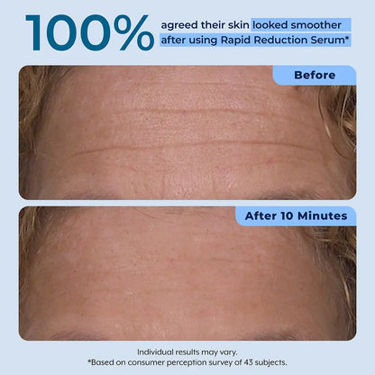 Rapid Reduction Serum – 1-Month Supply Plexaderm®