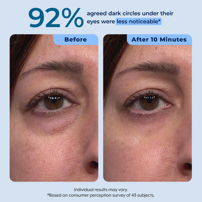 Rapid Reduction Serum – 1-Month Supply Plexaderm®